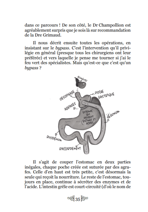 Mon parcours de bypassée - version brochée